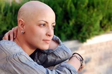 femme cancer perte de cheveux
