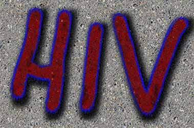 HIV sida